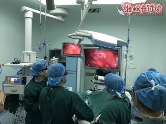 3D腹腔镜助力南华泌尿外科肾上腺手术